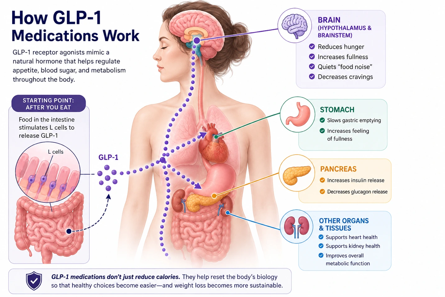 Article illustration 1 for How to Avoid Weight Regain After Stopping a GLP-1