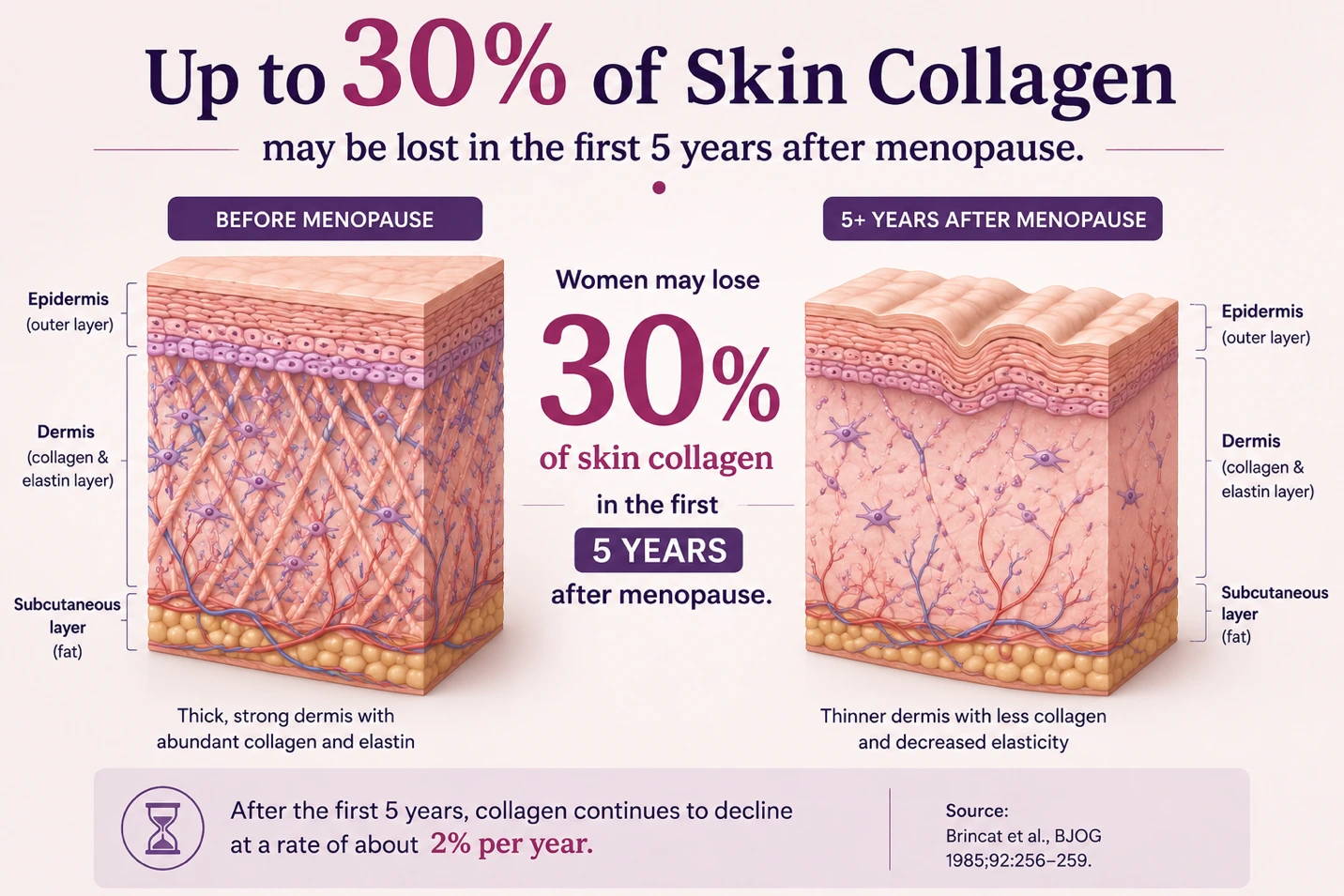 Article illustration 2 for What Really Happens To Your Skin In Menopause